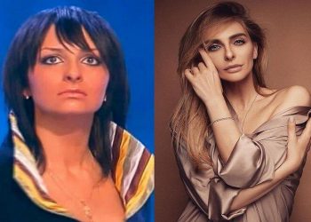 Измененные до неузнаваемости: 30 знаменитостей до и после пластики